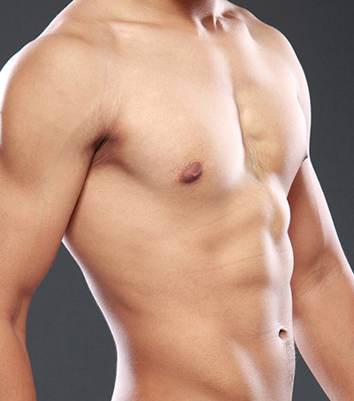 Male Breast Reduction