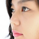 Blepharoplasty San Ramon