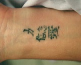 Laser Tattoo Removal