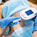 Female patient receiving cryolipolysis treatment